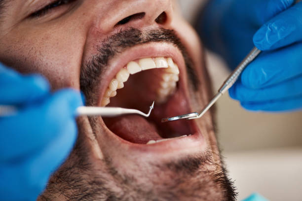 Why Choose Us for Your Dental Needs in St Louis, MI